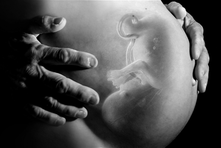 X光线 孕妇怀孕 婴儿 怀孕 
